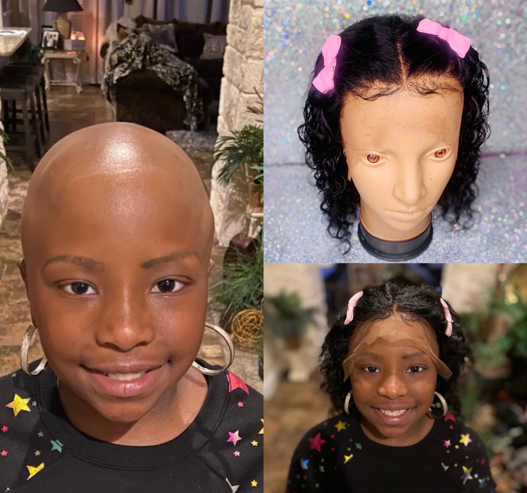 Children's wigs hair loss Clearance